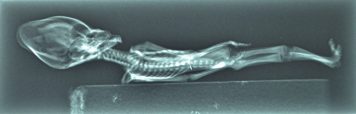 The 4 most influential X Ray technicians