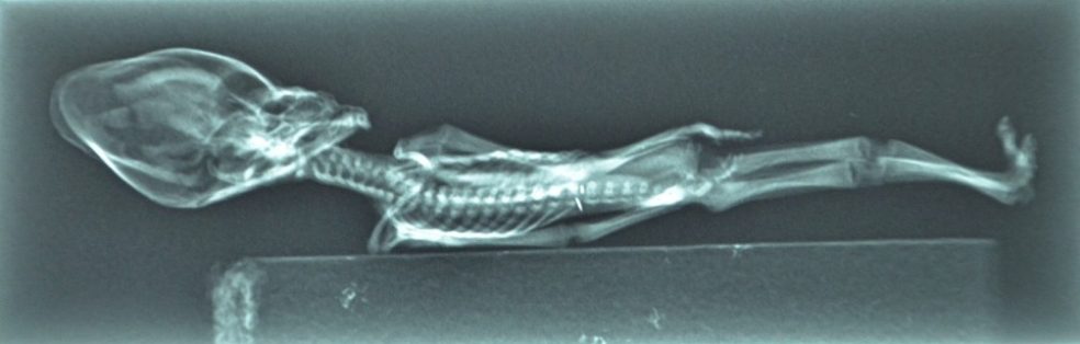 X-Ray